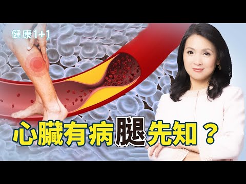 腿毛变少不是变美⚠️ 当心血管阻塞！这４大征兆揭露隐藏的心脏病风险｜健康1+1 · 影片