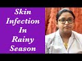 Skin infection in rainy season | Fungal infection during monsoon