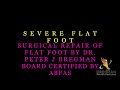 Flat foot correction by dr bregman for severe flat foot flatfeetfootsurgeryflat  feet