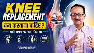 Signs You Need Knee Replacement | Knee Pain Treatment Guide | Knee Replacement Surgery?