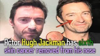 Actor Hugh Jackman has sixth skin cancer removed from his nose by Medical.Animation.Videos.Library 6,061 views 6 years ago 1 minute, 51 seconds