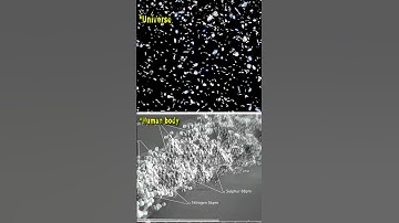 Universe zoom out vs human hair zoom in😲#shorts #space #universe