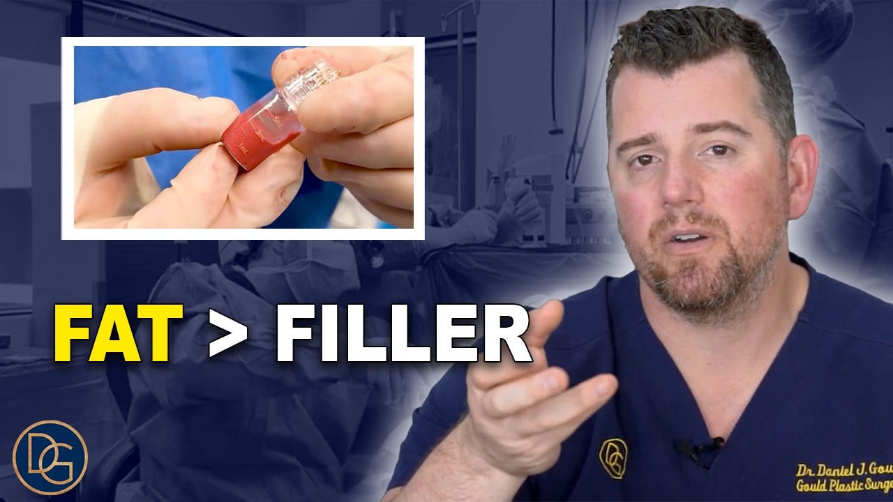 Fat Grafting: Using your own fat to improve the shape of your body and face