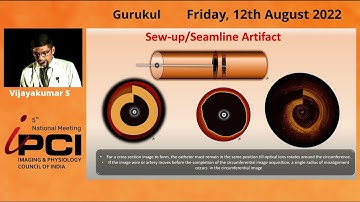 DR. VIJAYAKUMAR S- ARTIFACTS IN OCT