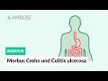 Morbus Crohn und Colitis ulcerosa - Worin unterscheiden sie sich? - AMBOSS Auditor