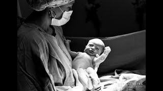 Projeto - O Primeiro Suspiro de Vida [Fotografia de Parto]