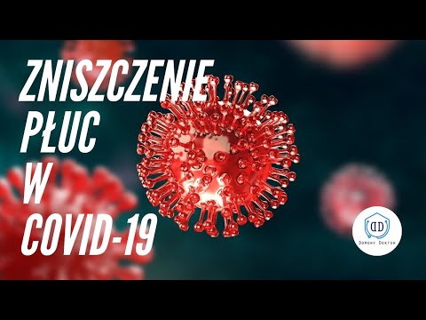 Wideo: Uszkodzenie płuc 70 procent z koronawirusem