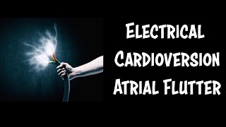 Emergency Cardioversion of Atrial Flutter