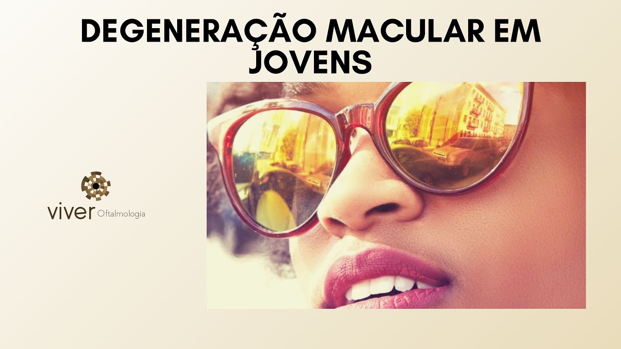 Degeneração macular em jovens | Dr Emmerson Badaró | Viver oftalmologia
