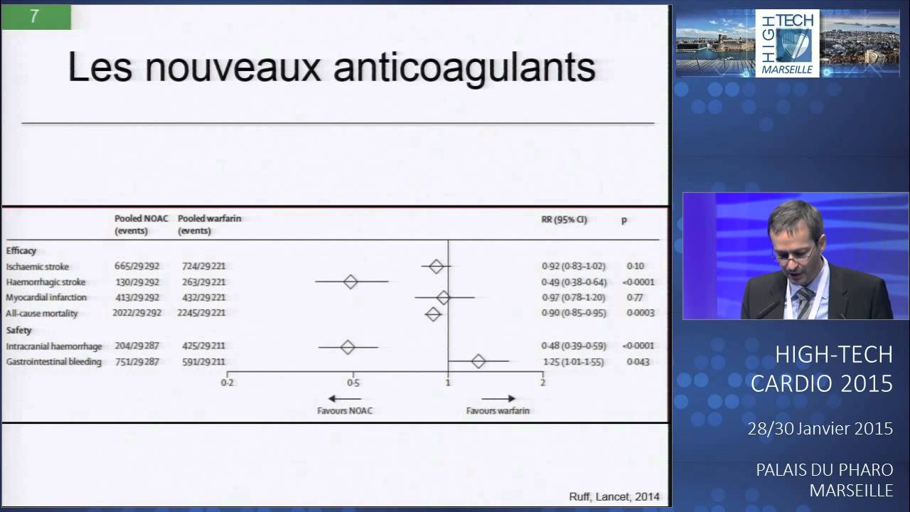 Fermeture auricule Pour quels patients ? YouTube Fermeture auricule Pour quels patients ? YouTube