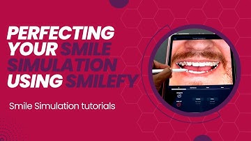 Perfecting your smile simulation using SmileFy