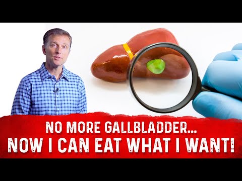 No More Gallbladder... Now I Can Eat What I Want!