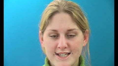 Lip segmentation for visual speech and speaker recognition