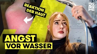 Wie ist das möglich?! Mercedés (18) kriegt Ausschlag von Wasser I TRU DOKU