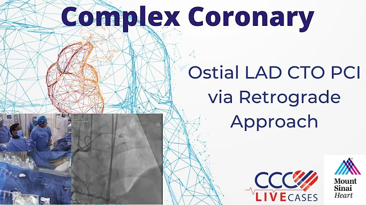 Ostial LAD CTO PCI via Retrograde Approach