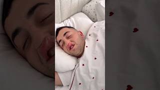 Kerim bu dudaklarıyla kime benzedi? 😂😂