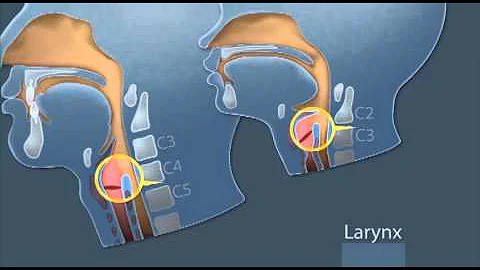 GlideScope Pediatric Airway Rounds: Small Anatomies