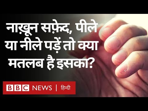 वीडियो: झटपट पानी कैसे जमा करें: 7 कदम (चित्रों के साथ)