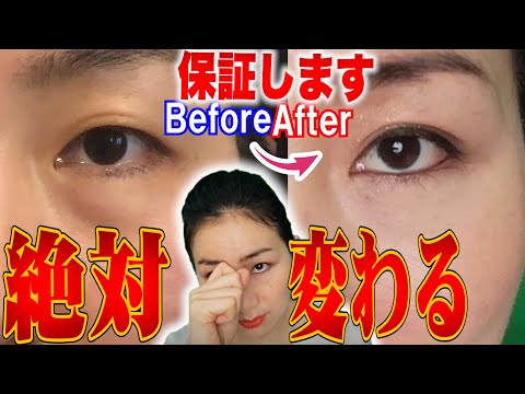 Tighten Eyelids and Make Beautiful Double eyelid in 7 days without Plastic Surgery