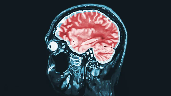 A Grandma Ate 1 Pound Chocolate In 6 Hours. This Is What Happened To Her Brain. - DayDayNews