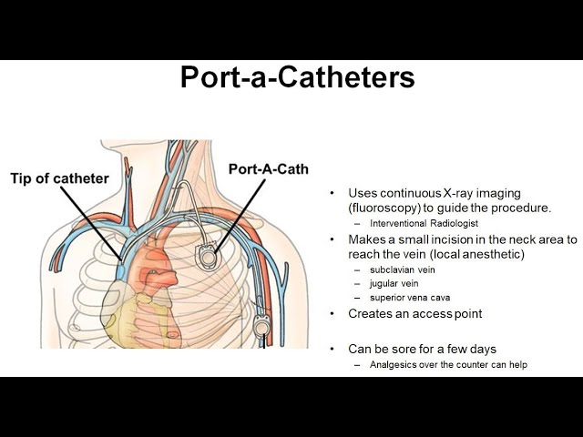 MEDICINE in a Nutshell: IV Cannulae, Syringes & Needles 