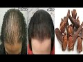 Indian secret🌱 to accelerate hair growth and treat baldness from the first week