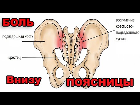 ✔Как разблокировать крестцово-подвздошный сустав?✔