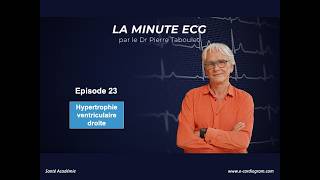 ECG minute 23. Right ventricular hypertrophy. Diagnosis and etiologies.