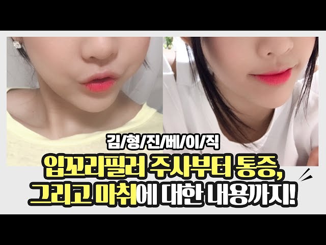입꼬리필러 주사부터 통증 그리고 마취까지