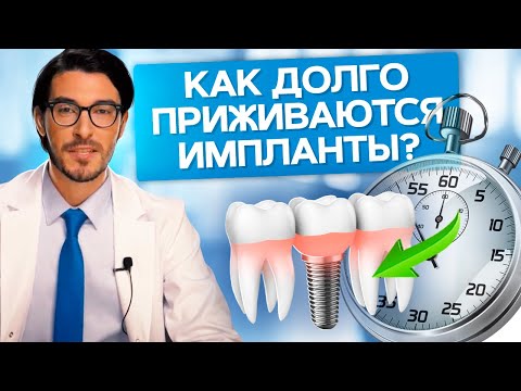 Как долго приживаются импланты? Как долго приживаются зубные импланты? Причины отторжения имплантов.