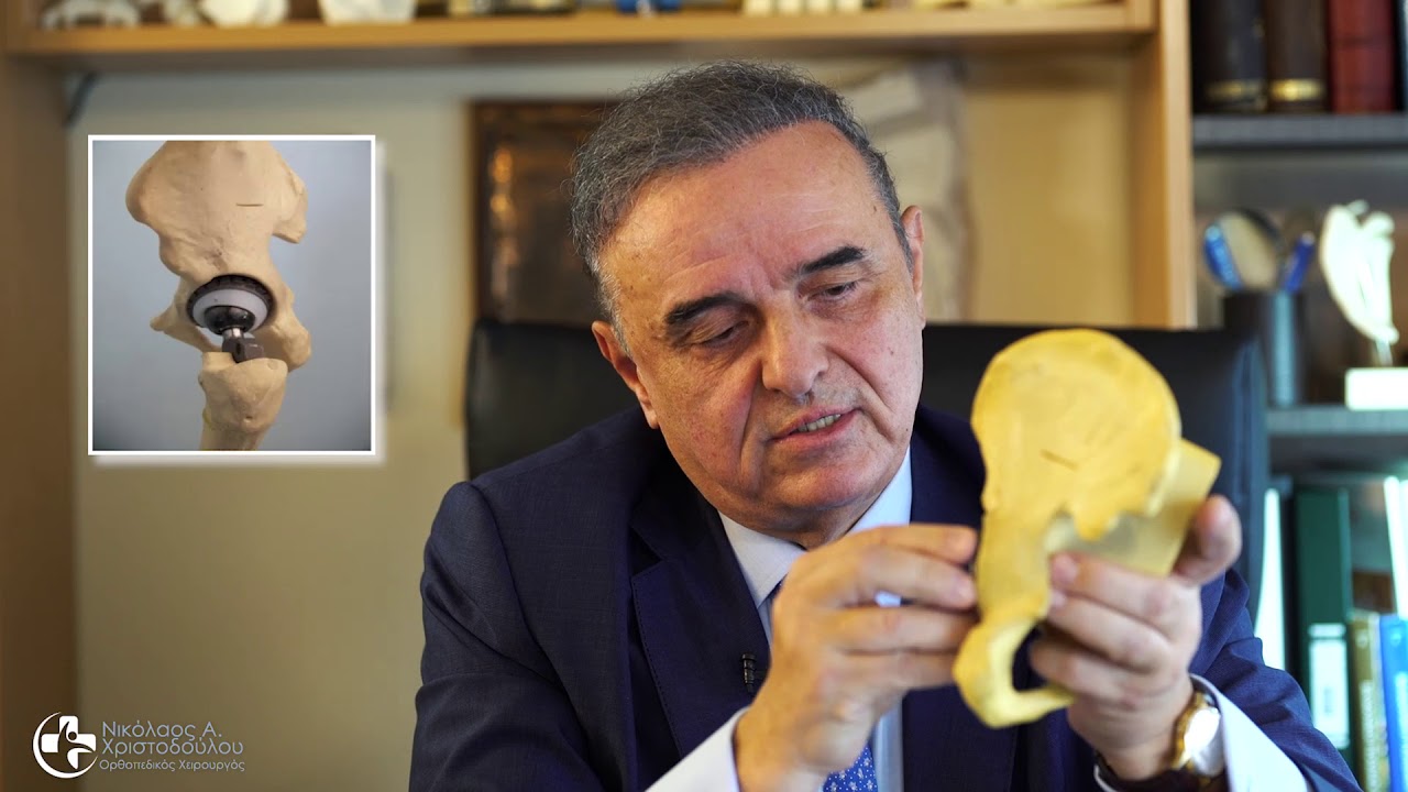 Νέα ALMIS Αρθροπλαστική Ισχίου με μικρά εμφυτεύματα βιοενσωμάτωσης