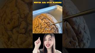 Inilah Bentuk Asli Otak Manusia