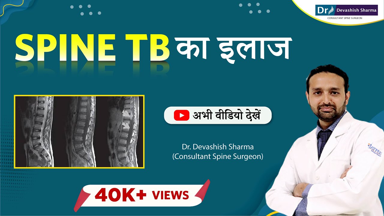 Spine TB Causes, Symptoms And Treatment in Noida & Delhi NCR | Spine Treatment - Dr Devashish Sharma