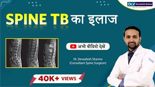 Spine TB Causes, Symptoms And Treatment in Noida & Delhi NCR | Spine Treatment - Dr Devashish Sharma