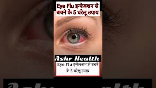 Eye Flu इन्फेक्शन से बचने के 5 घरेलू उपाय Ashr Health | #eyeflu | #homeremedies