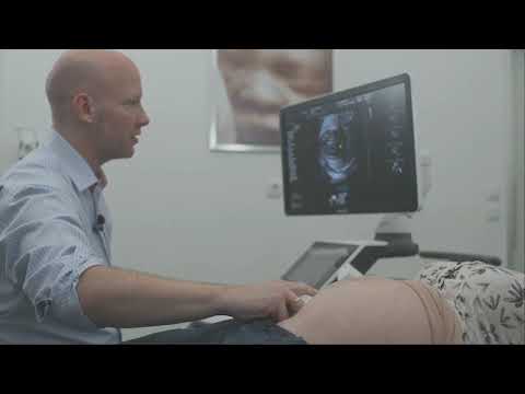 Video: Was ist Fetometrie in medizinischer Hinsicht?