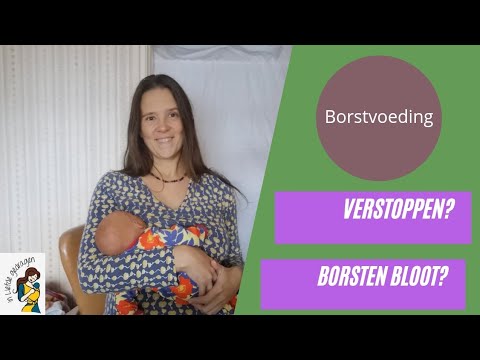 Video: Borstvoeding Geven In Het Openbaar: Ken De Wetten