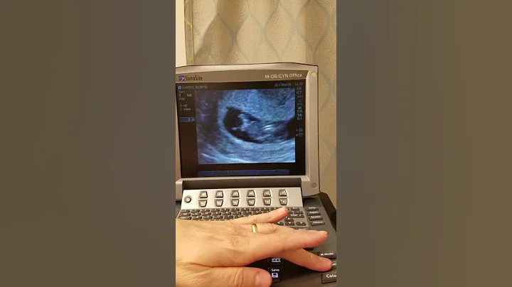 Robyn's Ultrasound 9 weeks