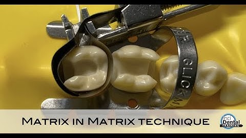 Matrix in matrix technique