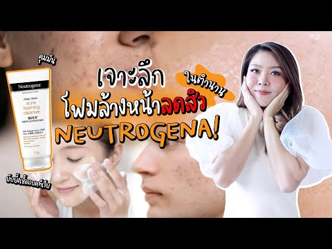 (เช็คสูตร)โฟมล้างหน้าลดสิวได้ดีสุดของ Neutrogena ดูแลต้นเหตุสิวครบ คุมมัน ผิวอุดตัน ฆ่าแบคทีเรีย!?