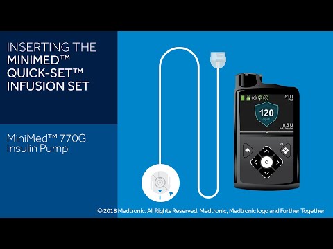 Inserting the Quick-set Infusion Set with the MiniMed™ 770G System