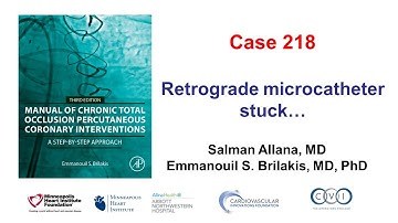 Case 218: Manual of CTO PCI - Retrograde microcatheter entrapment
