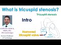 What is tricuspid stenosis? - Intro