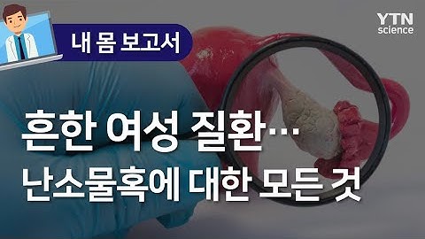 [내 몸 보고서] 흔한 여성 질환…난소물혹에 대한 모든 것 / YTN 사이언스