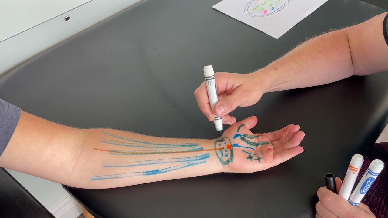 Carpal Tunnel Syndrome Anatomy and How To Treat It! CTS 