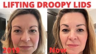 Ways to lift droopy hooded eyelids without surgery