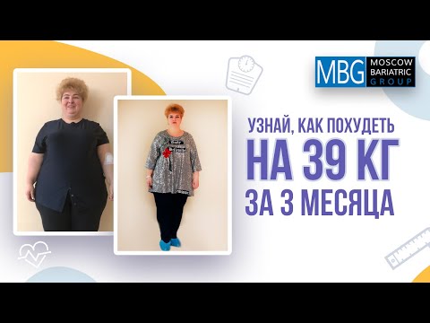 минус 39 кг за 3 месяца | Отзыв после бариатрической операции