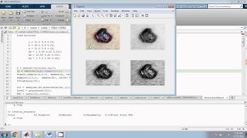 IEEE MATLAB BIOMEDICAL