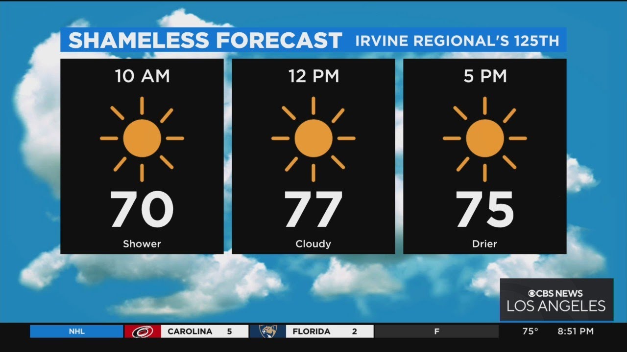 Shameless Forecast Irvine Regional's 125th Anniversary Celebration