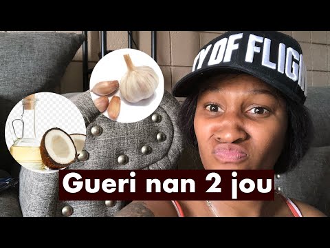 Si bouboune ou gen gratel,infection, movè odè min kijan ou tretel ak 2 ingredients nan 2 jou.